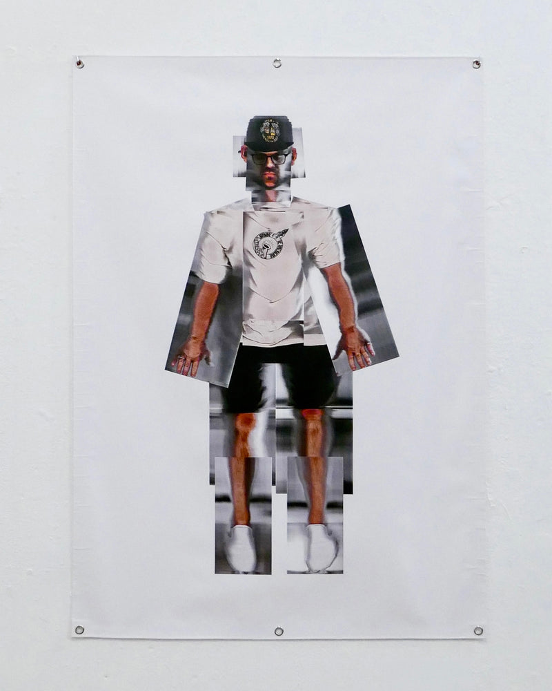 Scanatomy